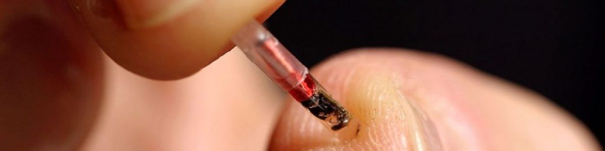 É real: Empresa implanta microchip nos funcionários
