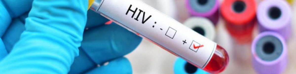 Cientistas eliminam o HIV em seis pacientes com células estaminais