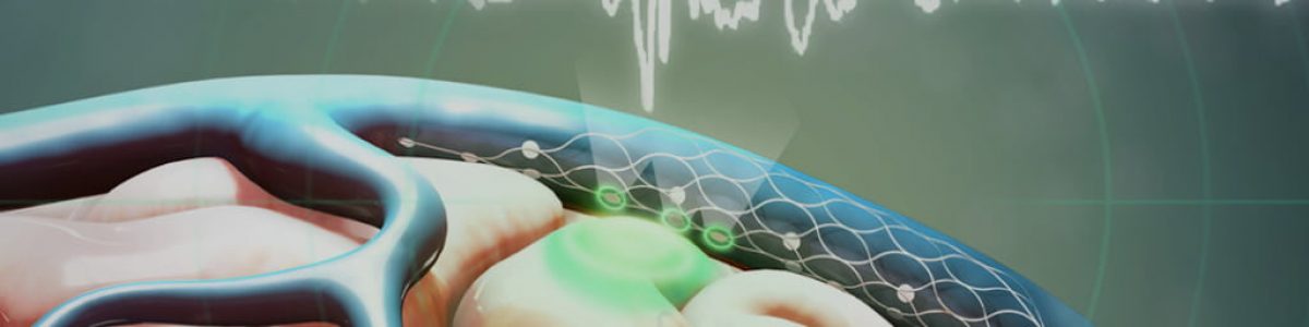 Synchron recebe aprovação para testar implante cerebral em humanos