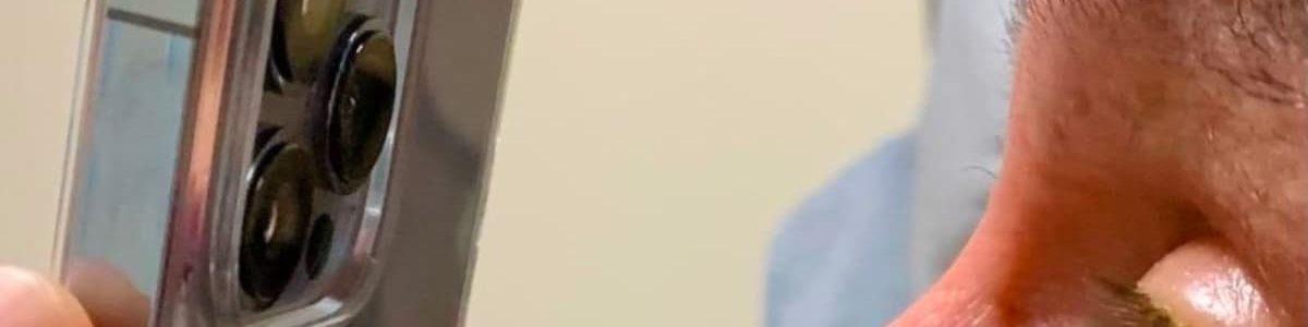 Médico usa câmara do iPhone 13 Pro para tirar imagens macro dos olhos de paciente