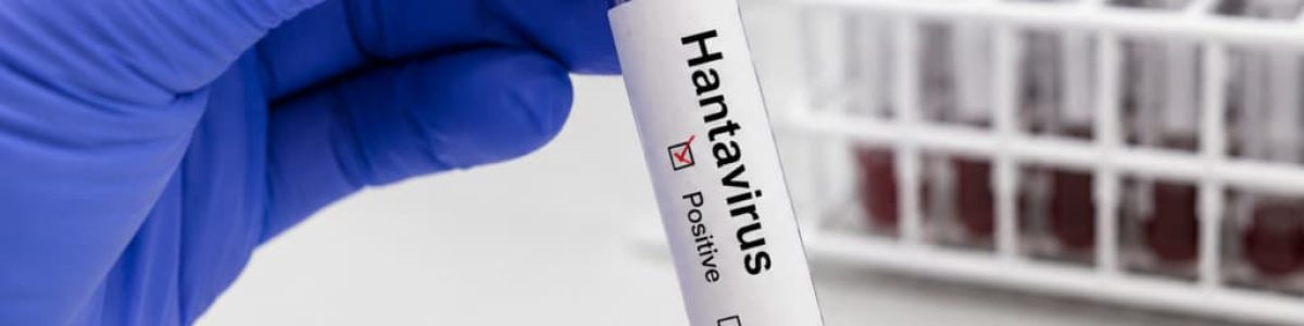 Primeiro caso suspeito de hantavírus em Espanha