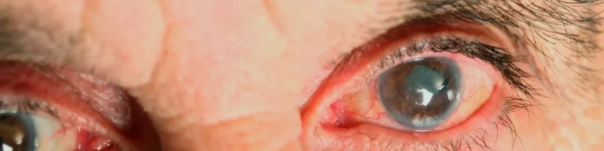 Há um dispositivo tecnológico que está a transformar a cirurgia às cataratas